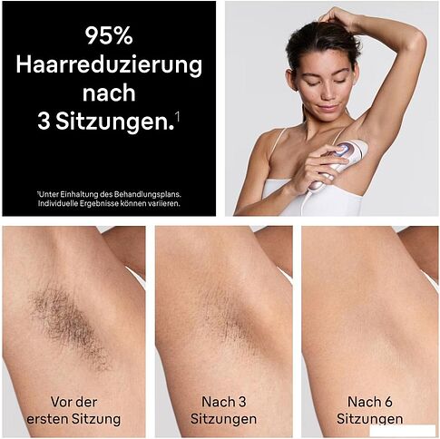 Фотоэпилятор Braun Skin i-Expert PL7321