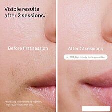 Фотоэпилятор Braun Silk-expert Pro 5 PL5242