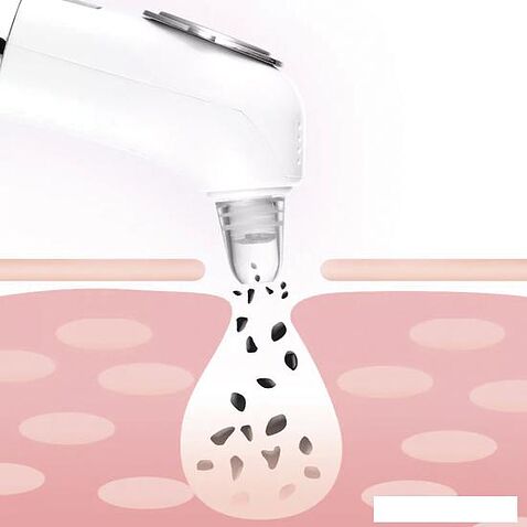 Прибор для вакуумной чистки Kitfort KT-3126