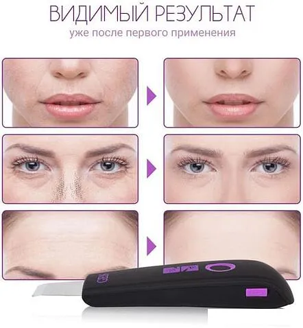 Прибор для ультразвукового пилинга Gess You GESS-689