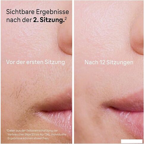 Фотоэпилятор Braun Silk-Expert Pro 5 PL5140