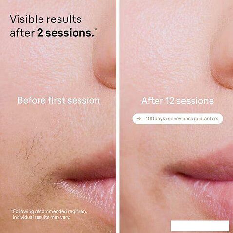 Фотоэпилятор Braun Silk-expert Pro 5 PL5242