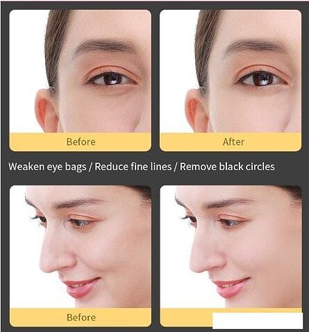 Многофункциональный массажер InFace MS5000 (розовый)