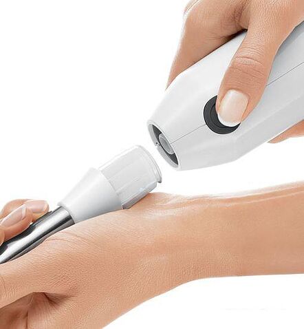 Погружной блендер Bosch MS61A4110