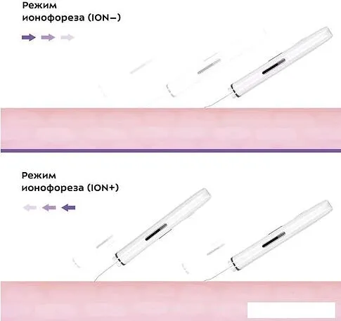 Прибор для ультразвукового пилинга Kitfort KT-3113