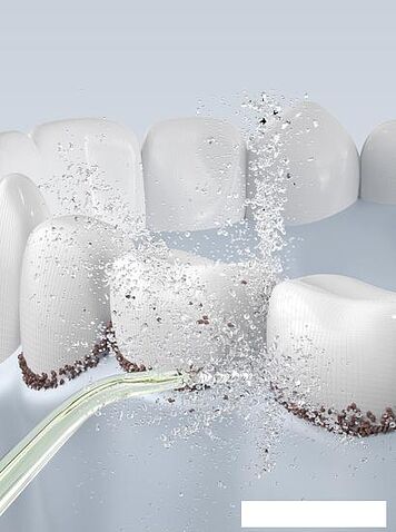 Ирригатор Oclean W10 (розовый)